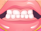 Плохие зубы